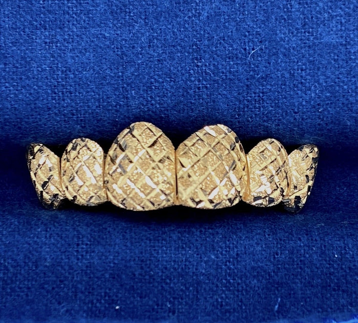 How To Clean Gold Grillz After Smoking Iceberg Diamonds at Boulevard Mall