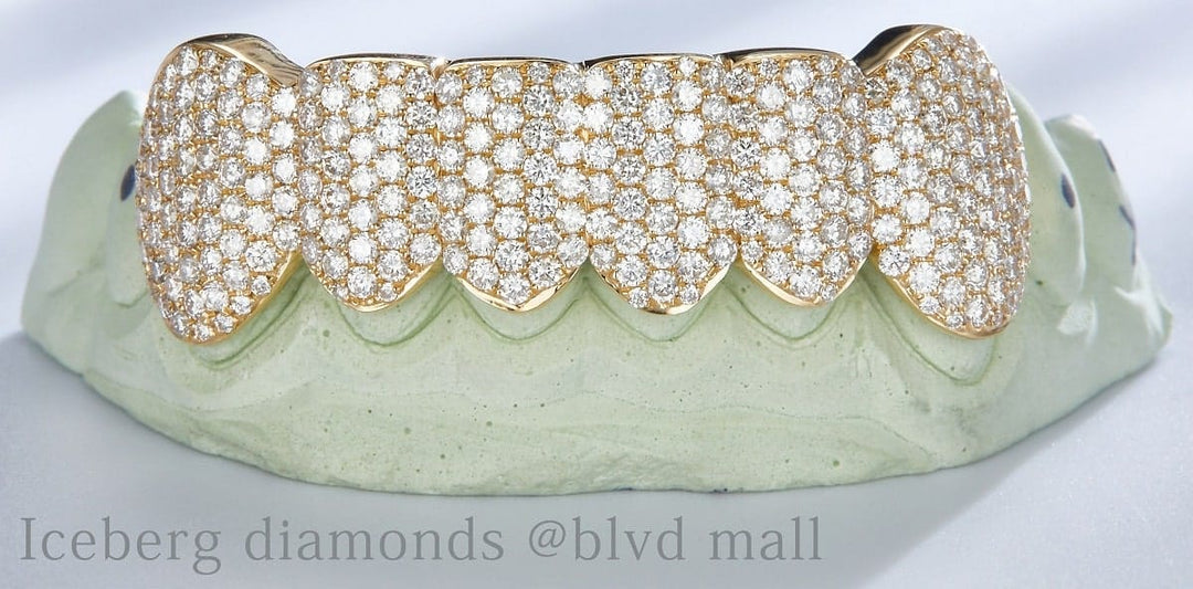 Iced-out diamond grillz