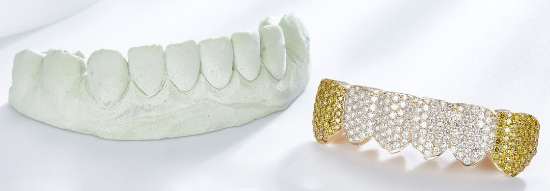 Custom gold and diamond grillz by Iceberg Diamonds in Las Vegas
