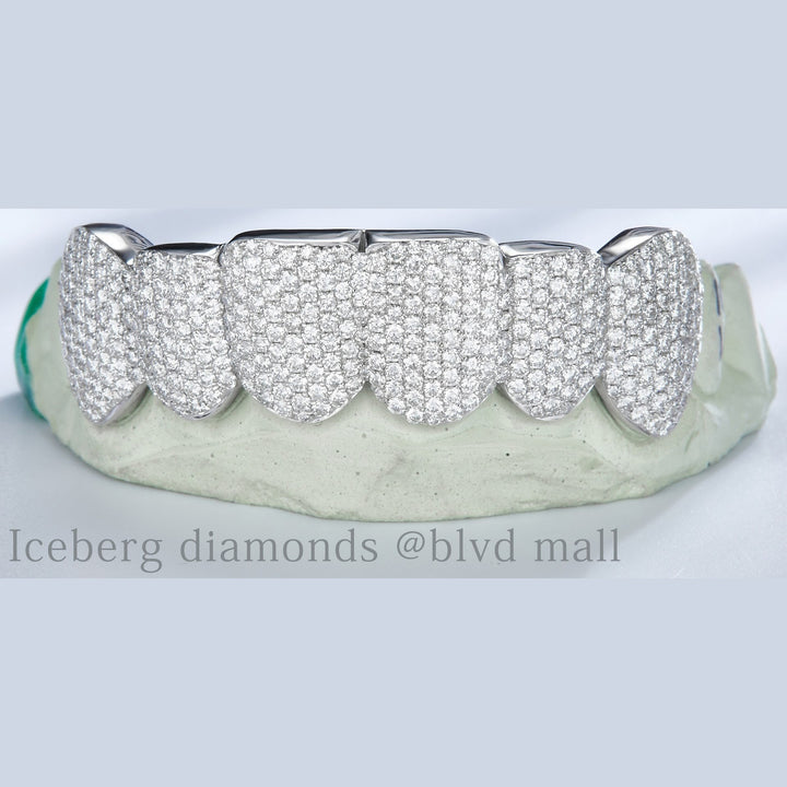 Moissanite Gold Grillz 4 Teeth
