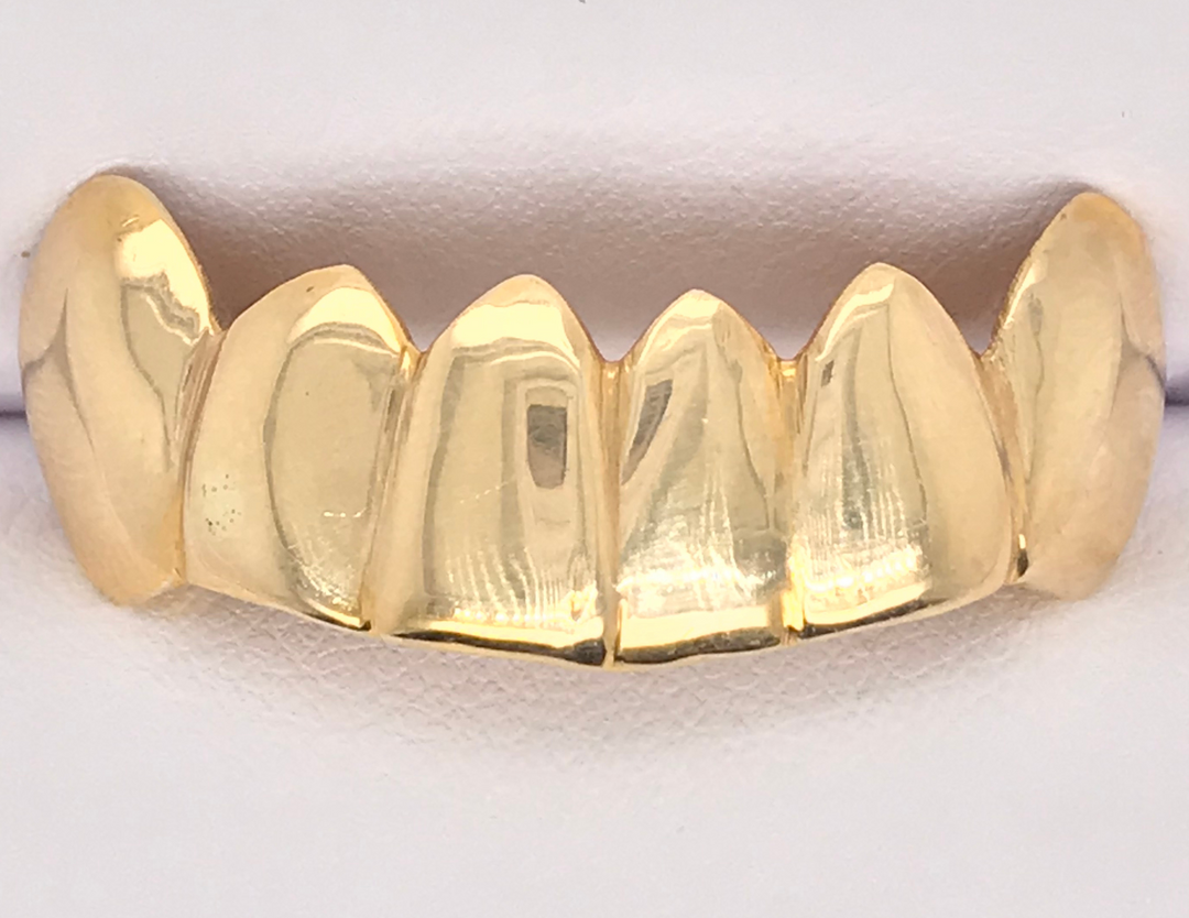 High Polish Gold Grillz 6 Teeth