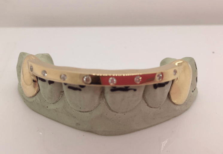 Grillz Get Inspired in Las Vegas, NV Iceberg Diamonds at Boulevard Mall