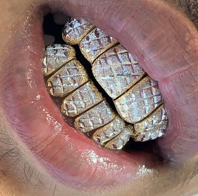 Two Tone with Diamond Cuts + Diamond Dust + Perm Cut Grillz 12 Teeth