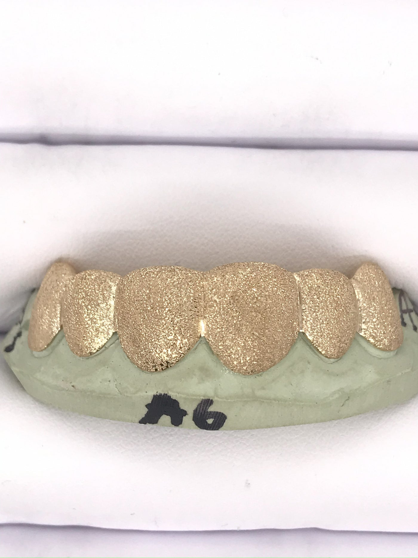 Diamond Dust Gold Grillz 8 Teeth