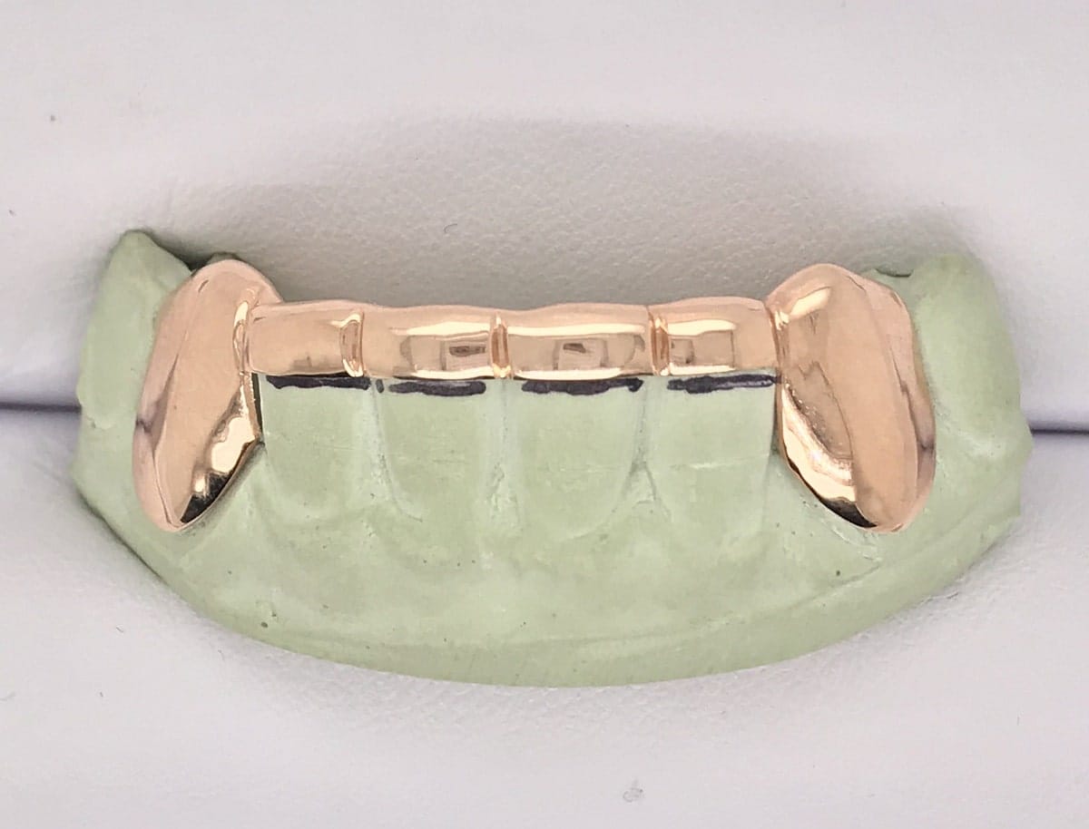 Grillz Get Inspired in Las Vegas, NV Iceberg Diamonds at Boulevard Mall