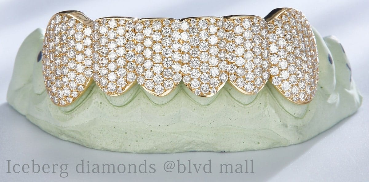 Iced-out diamond grillz