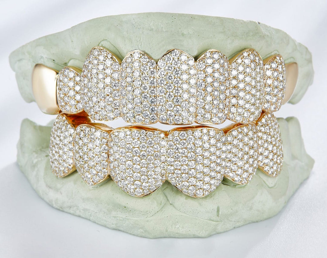 custom grillz with diamonds