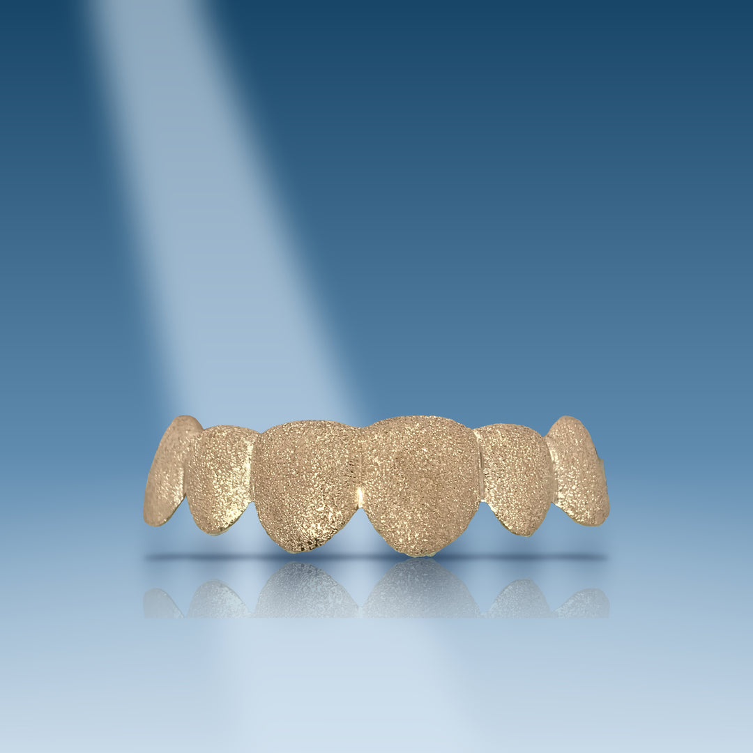 diamond-dust-gold-grillz-2-teeth