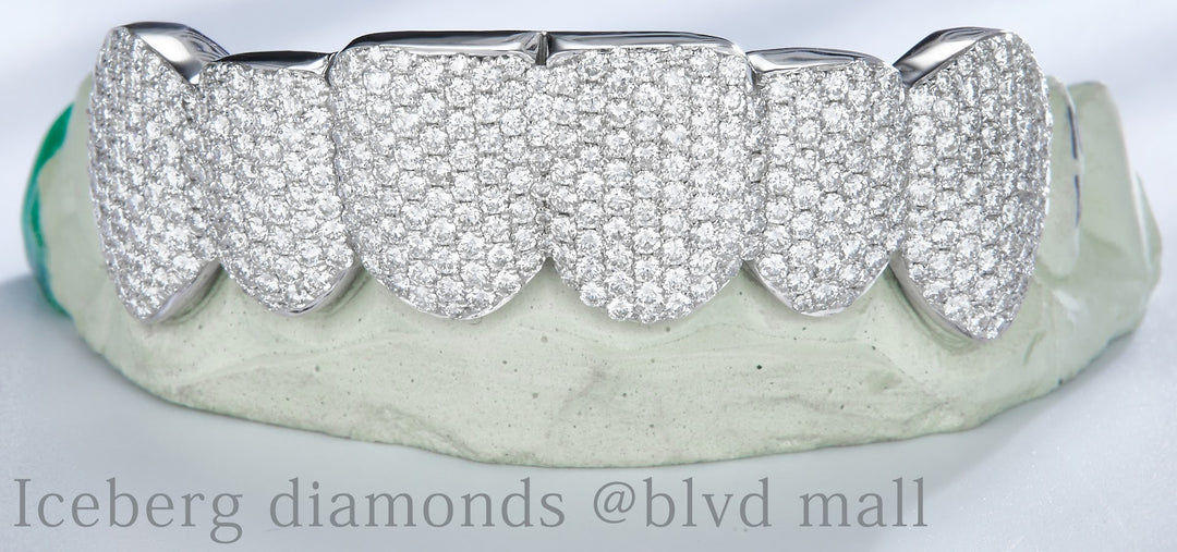 Moissanite Gold Grillz Fangs w/Bar Hidden